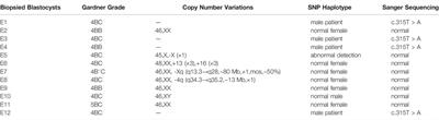 Case Report: Preimplantation Genetic Testing for X-Linked Severe Combined Immune Deficiency Caused by IL2RG Gene Variant